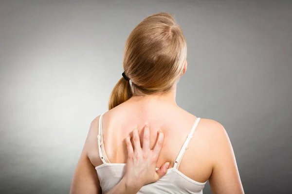 Frau kratzt sich mit allergischem Ausschlag am juckenden Rücken — Stockfoto