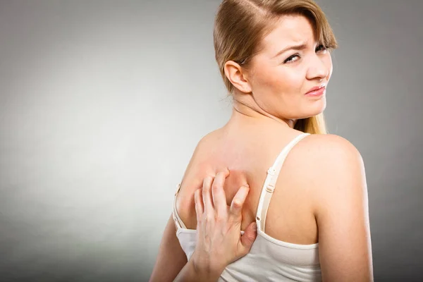女性アレルギーの発疹のかゆみ背中を掻く — ストック写真