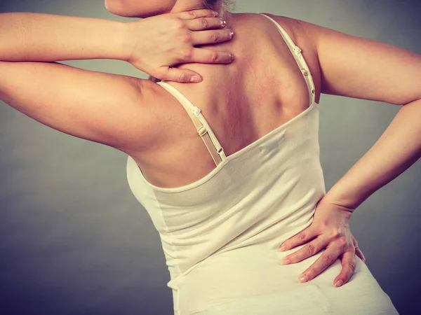 Mujer rascándose la espalda con picazón con erupción alérgica — Foto de Stock