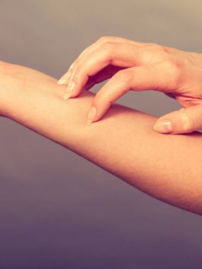 Dişi kaşınan kolunu alerji isiliği ile kaşıyor.