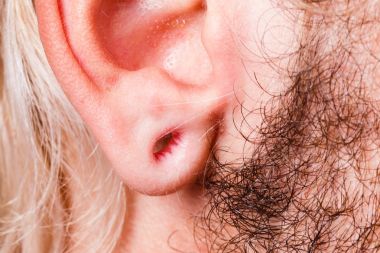 Tünel piercing sonra gergin adam kulak