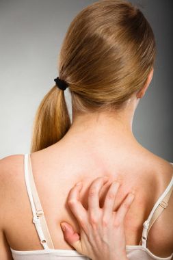 Anti döküntü ile kaşıntılı onu geri tırmalamak kadın