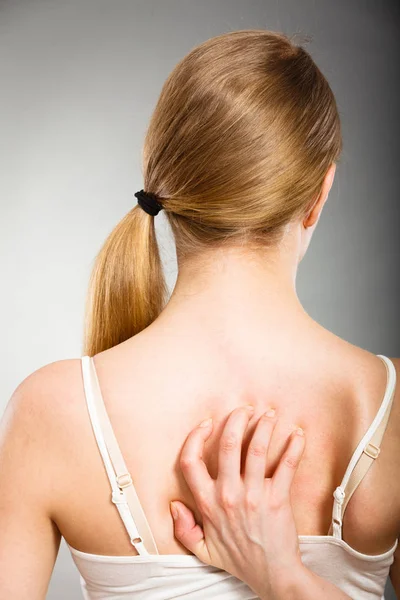 Nainen raapiminen hänen kutiava takaisin allergia ihottuma — kuvapankkivalokuva
