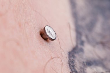 Göğüs kemiği, bölünme, microdermal, köprücük üzerinde piercing yüzey.