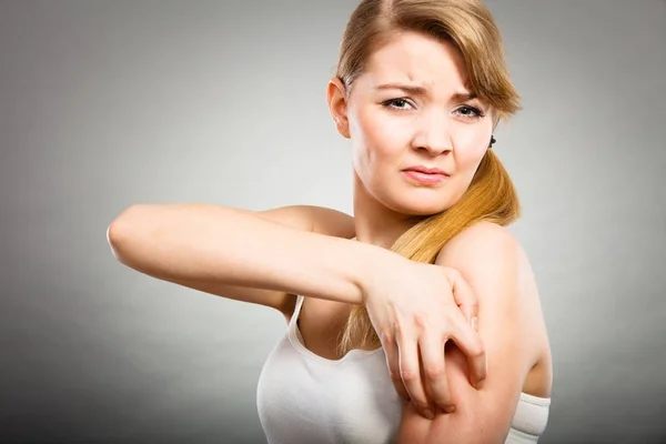 Mujer rascarse el brazo picante con erupción alérgica — Foto de Stock