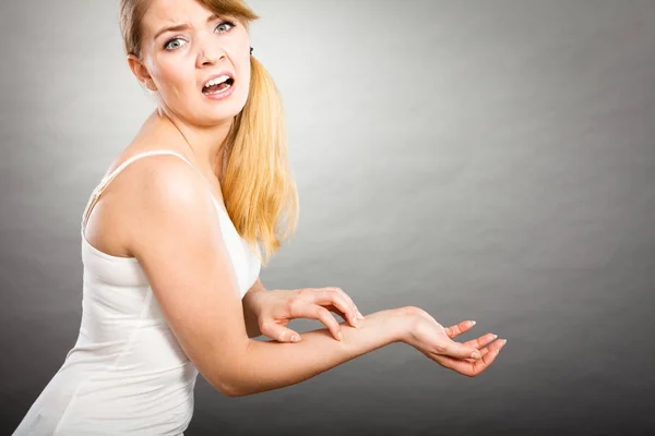 Mujer arañándose el brazo con picazón con erupción alérgica —  Fotos de Stock