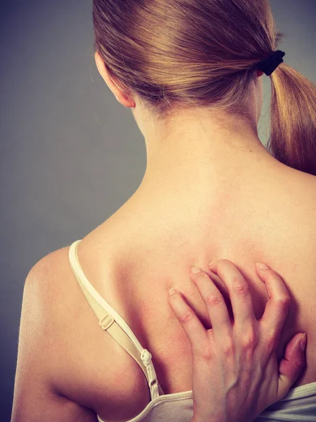 Vrouw haar jeukende terug met allergie huiduitslag krabben — Stockfoto