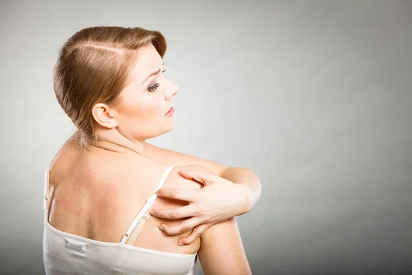 女性アレルギーの発疹のかゆみ背中を掻く — ストック写真