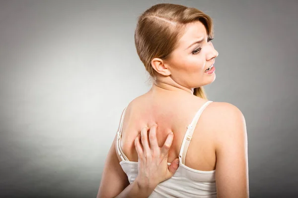 Женщина царапает спину зудом аллергической сыпью — стоковое фото
