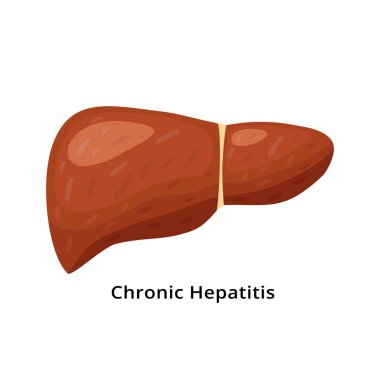 Kronik hepatit karaciğer ikonu beyaz arka planda izole edilmiş. Düz dizaynlı karaciğer hastalığı çizimi.
