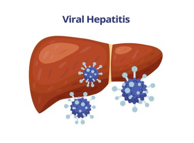 Beyaz arkaplanda izole edilmiş viral hepatit, karaciğer ve virüs vektör düz çizim hasarı.