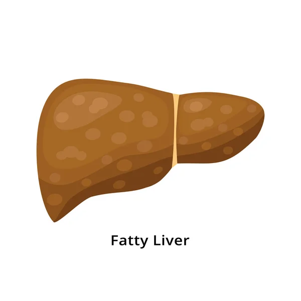 白い背景に脂肪肝アイコンが隔離されています。平らなデザインの肝疾患の概念図. — ストックベクタ
