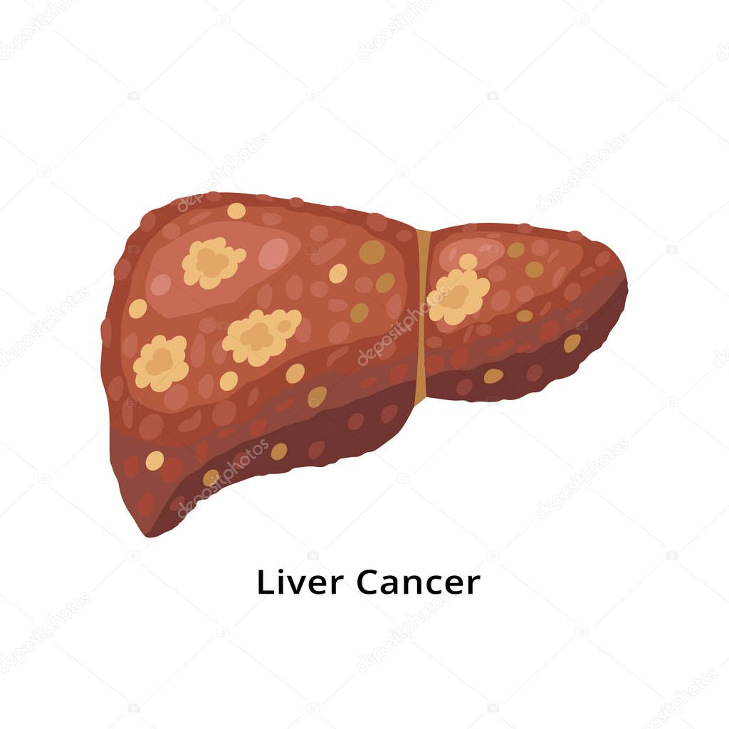 Liver cancer icon isolated on white background. Liver disease concept illustration in flat design.