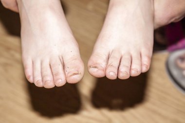 Kirli ayaklarını gösterilen bir çocuk