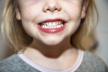 Küçük kız süt dişlerini sunulması