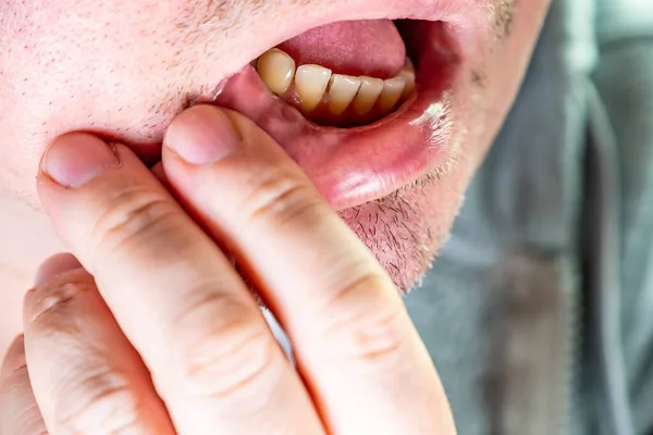 Close up of exposed tooth necks of man — Stock Photo, Image