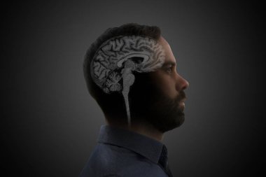 Beyin manyetik rezonans görüntünün bir adamın baş profil üzerine.