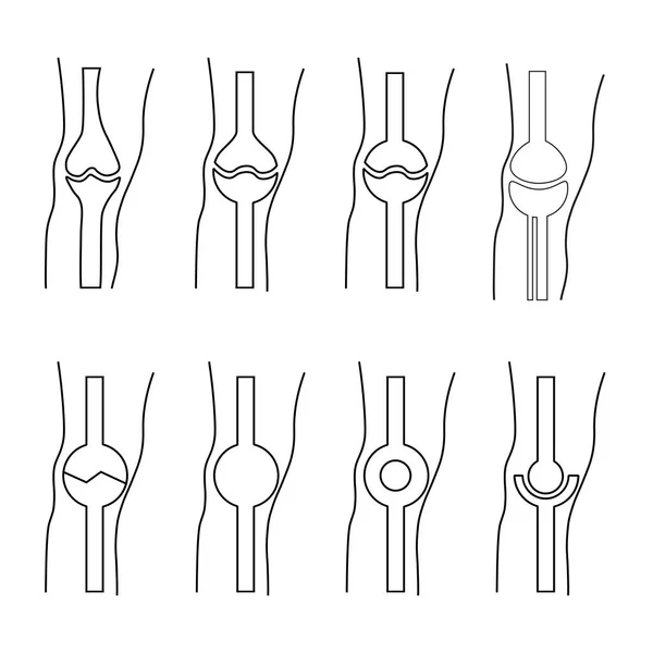 Articulación humana — Archivo Imágenes Vectoriales