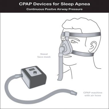 Uyku apnesi, Cpap makine, burun maskesi