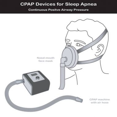 Uyku apnesi, Cpap makine, burun ağız maskesi