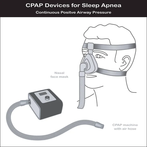 Uyku apnesi, Cpap makine, burun maskesi