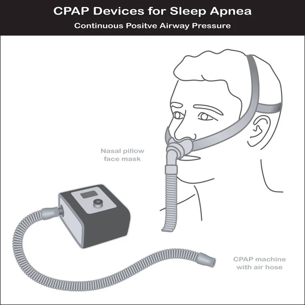 Uyku apnesi, Cpap makine, burun yastık maskesi