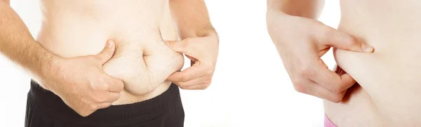 Mão segurando barriga gordura closeup — Fotografia de Stock