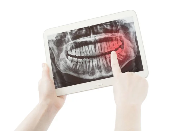 Handen Tonen Pijn Tanden Radiologie Radiografie Tablet Scherm Geïsoleerd Wit — Stockfoto