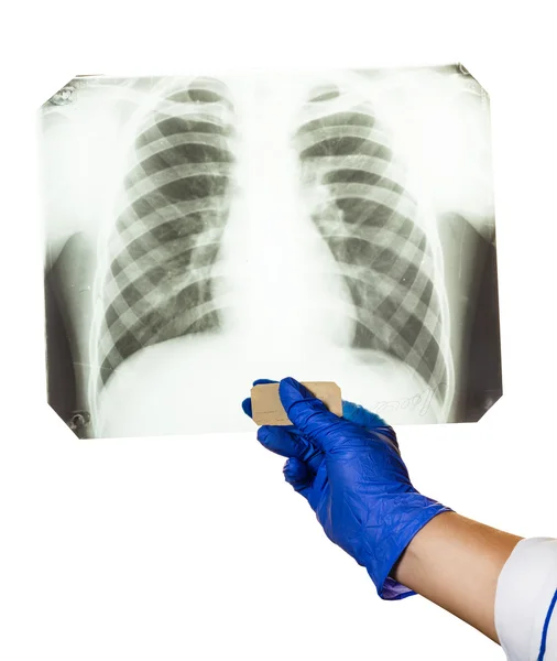 Arzt sucht Röntgenbild — Stockfoto