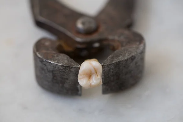 O dente removido e alicate — Fotografia de Stock