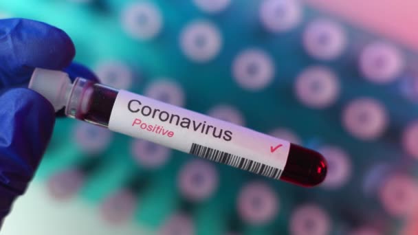Hälso Och Sjukvårdspersonal Som Visar Positivt Resultat Coronavirus Test Många — Stockvideo