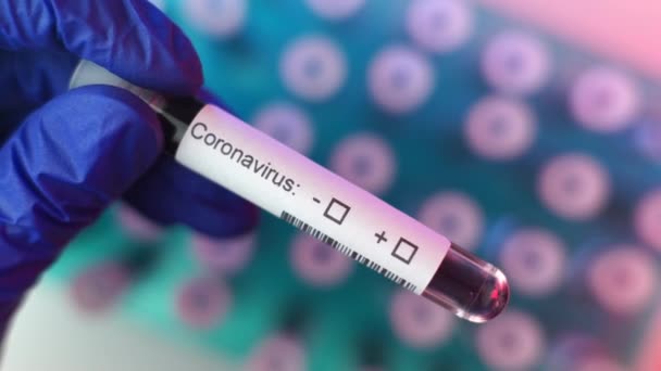 Hälso Och Sjukvårdspersonal Som Visar Positivt Resultat Coronavirus Test Många — Stockvideo