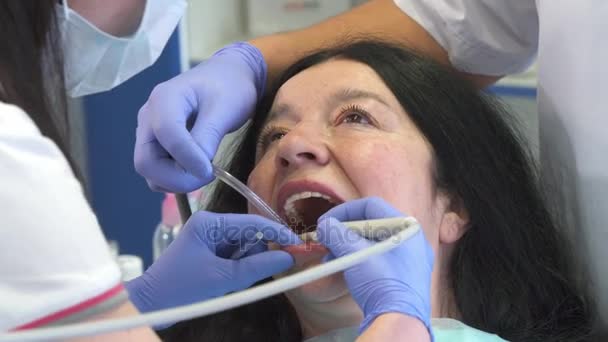 Dentista fornece irrigação oral para o cliente — Vídeo de Stock