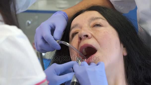 Стоматолог полирует нижние зубы клиентов — стоковое видео