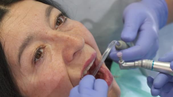Tandläkare polerar klienter övre tänder — Stockvideo