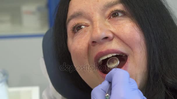 Женщина открывает рот для осмотра зубов — стоковое видео