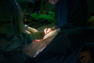 Doktorlar bir anne yaranın üzerine çalışma