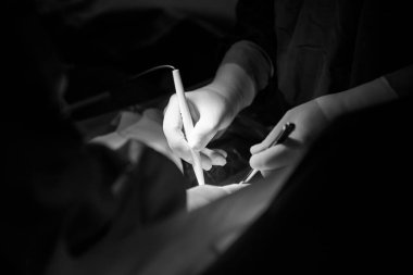 Doktorlar bir anne yaranın üzerine çalışma