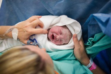 Hastanede vernix bebekle kaplanmış yeni doğmuş bir bebeğin yakın plan görüntüsü.