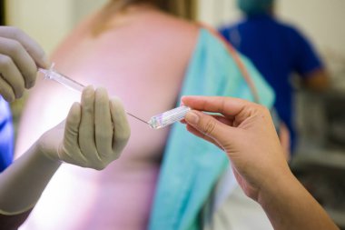 Hamile bir kadın için epidural spinal blok yapan bir doktorun yakın plan görüntüsü.