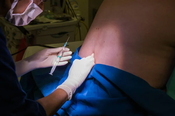 Imagen Cerca Médico Realizando Bloqueo Epidural Columna Vertebral Para Una —  Fotos de Stock