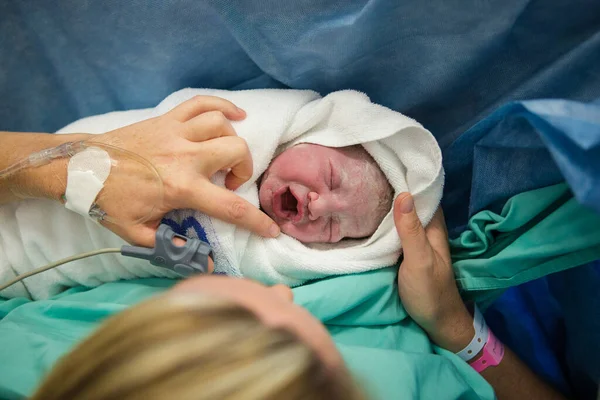 Close Image Newly Born Covered Vernix Baby Hospital — Stock Photo, Image