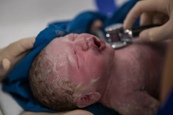 Hastanede Vernix Bebekle Kaplanmış Yeni Doğmuş Bir Bebeğin Yakın Plan — Stok fotoğraf