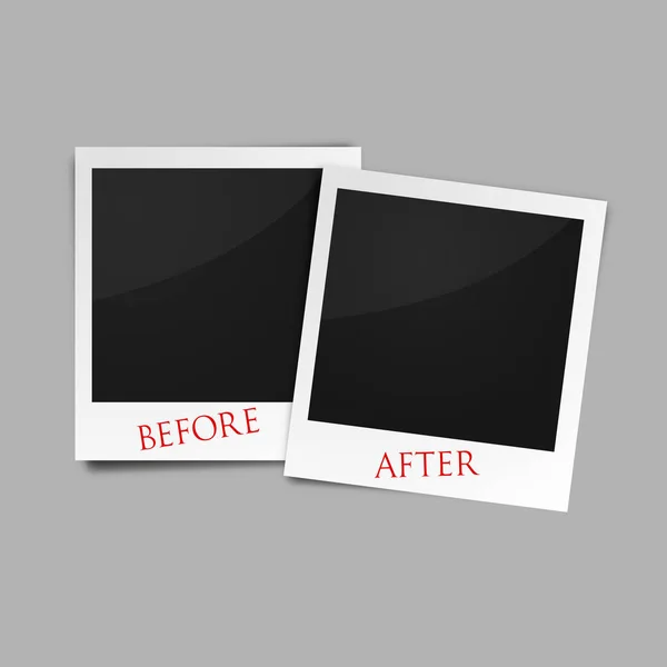 Antes y después de fotogramas vector — Vector de stock