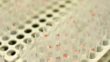 Tüp bebek örnekleri