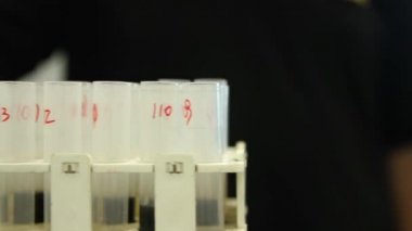 Tüp bebek örnekleri