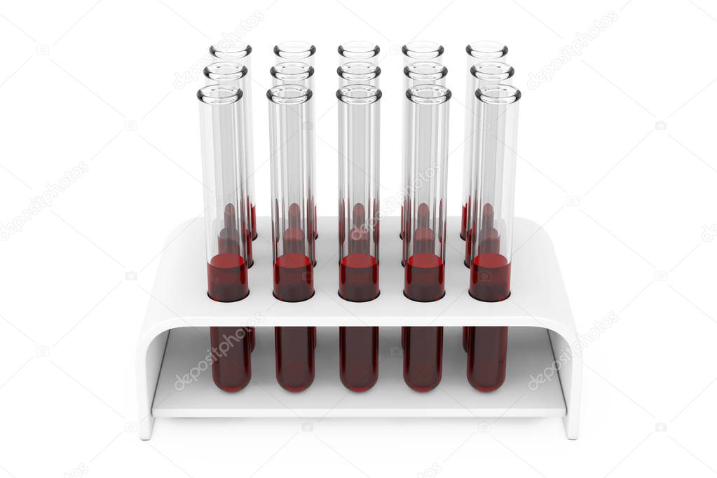 Glass Laboratory Chemical Test Tubes Flasks with Blood Samples i