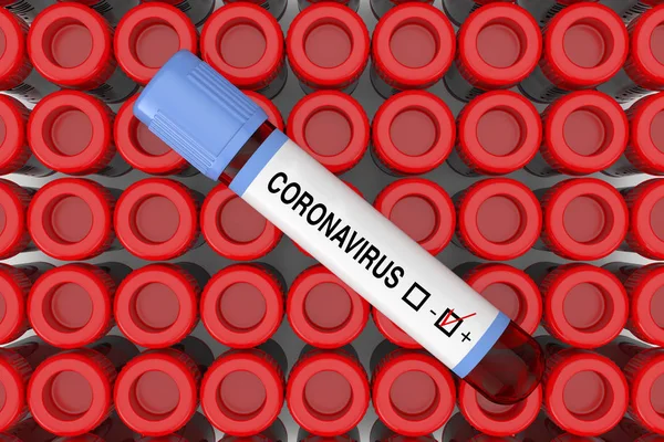 Blood Test Flask Tube Coronavirus Positive Result Rows Test Flask — Stock fotografie