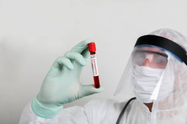 Solunum maskesi takan ve Coronavirus Covid-19 kan örneğini elinde tutan bir doktor. Hastane kliniğinde kan örnekleriyle çalışan bir doktor. 