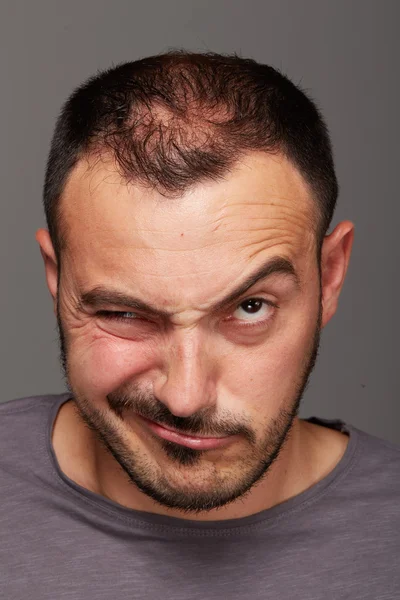 Hombre haciendo una expresión facial divertida — Foto de Stock